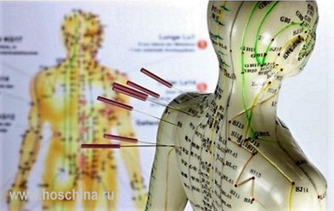 Китай лечение миомы матки в китае thumbnail